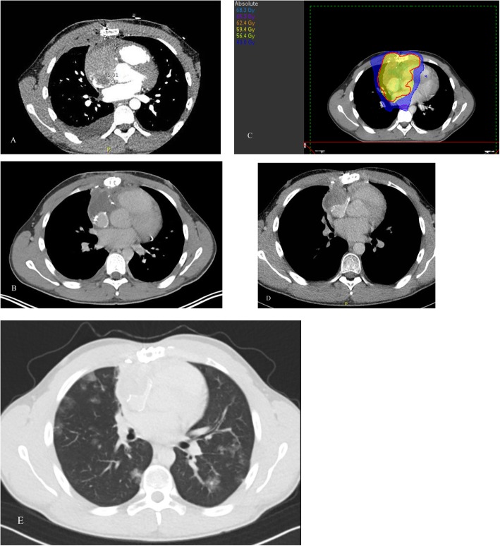 Fig. 2