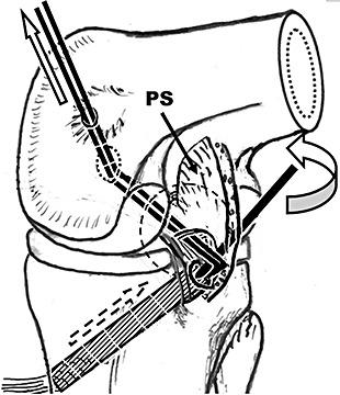 Figure 9