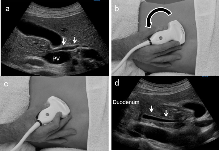 Fig. 4