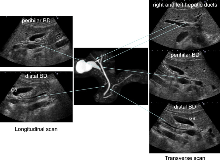 Fig. 1