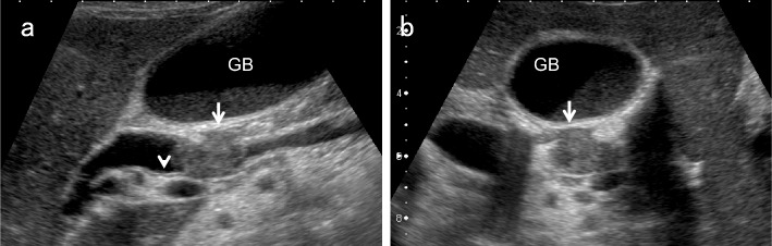 Fig. 16