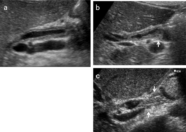 Fig. 12