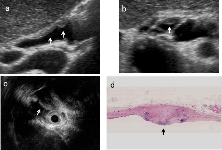 Fig. 11