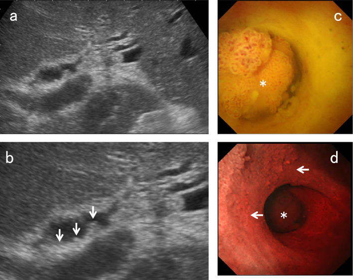 Fig. 14