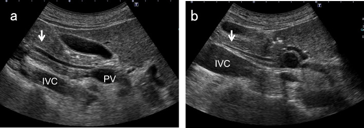 Fig. 5