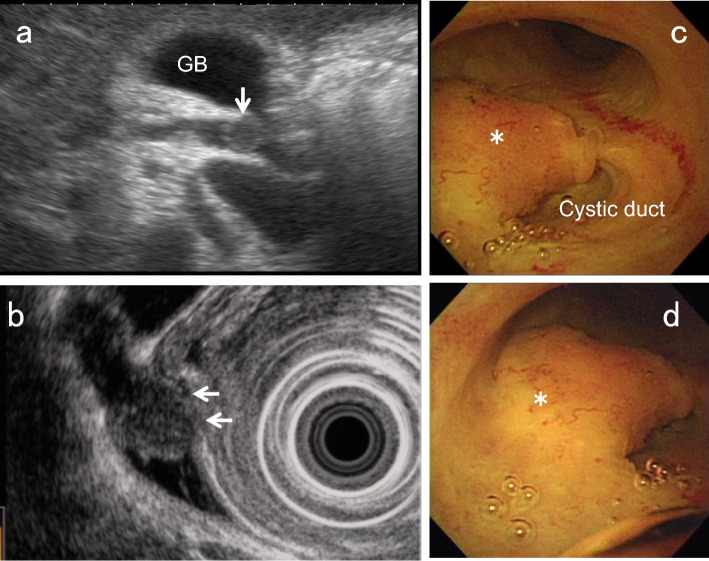 Fig. 13