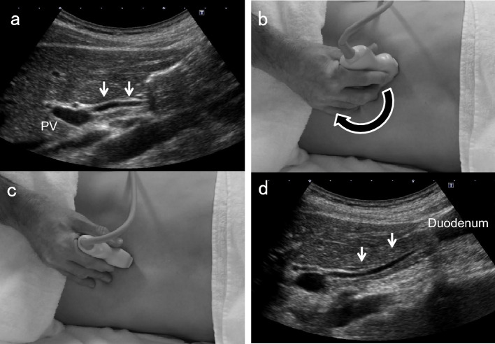 Fig. 2