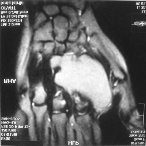 Figure 2