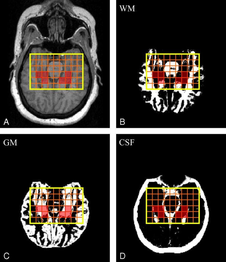 Fig 2.