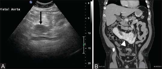 Figure 3(A and B)