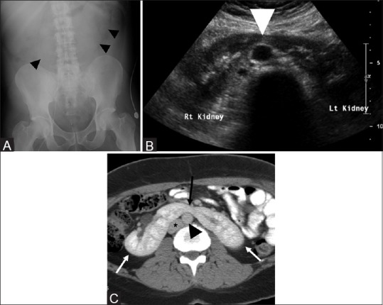 Figure 1(A-C)