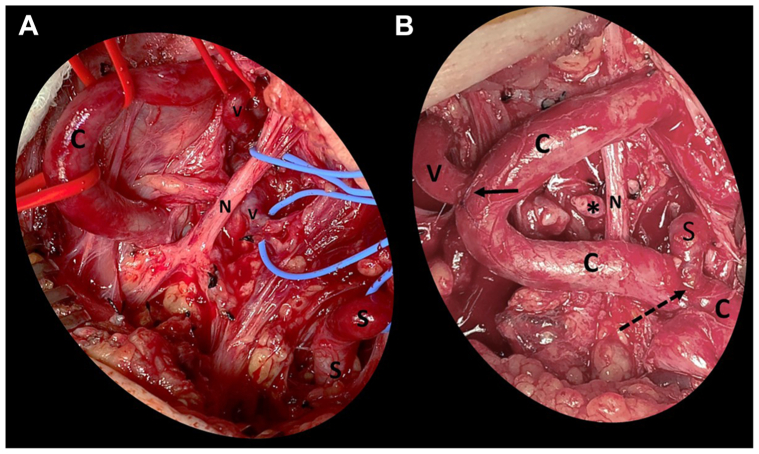 Fig 2