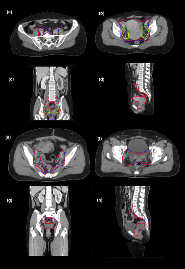 FIGURE 3