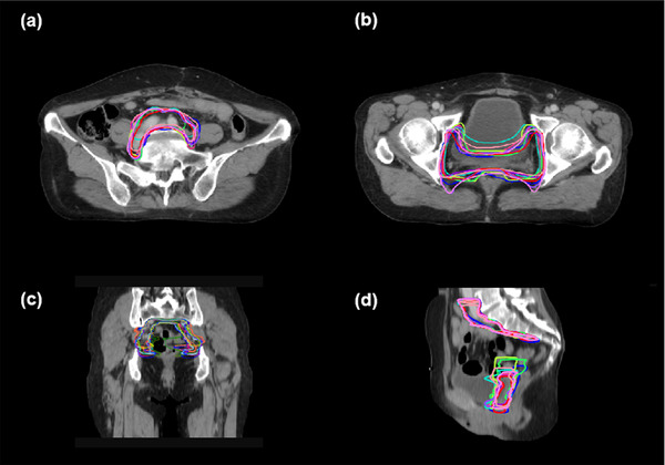 FIGURE 4