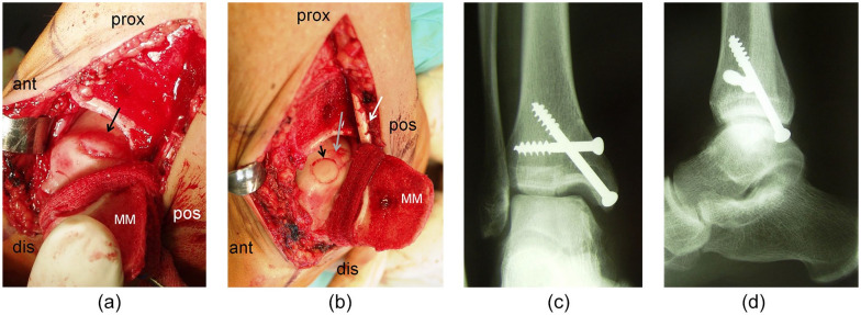 Figure 2.