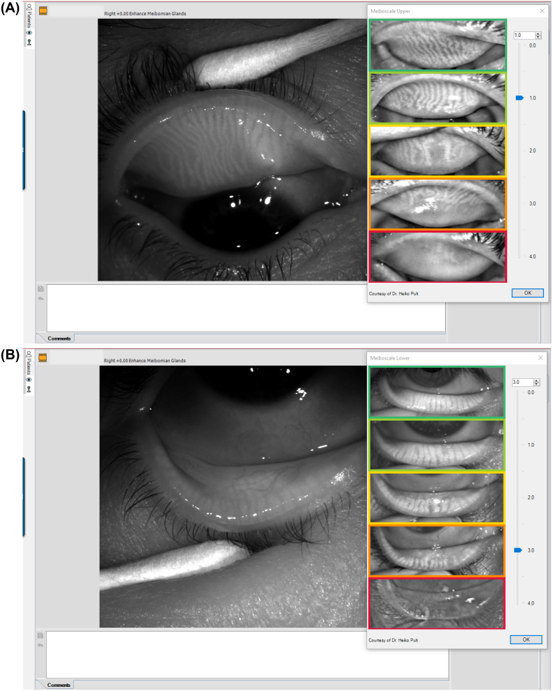 Figure 14