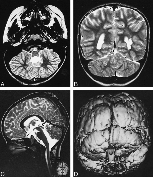 fig 1.