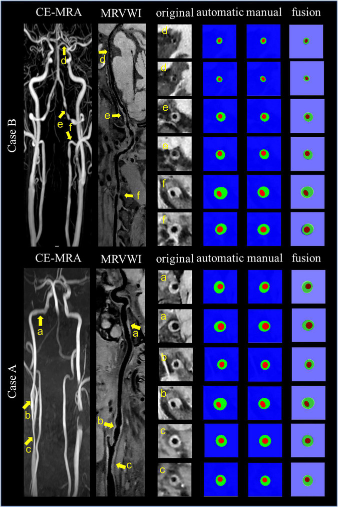 FIGURE 6