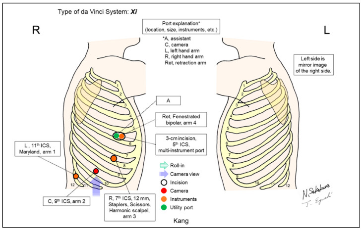 Figure 14