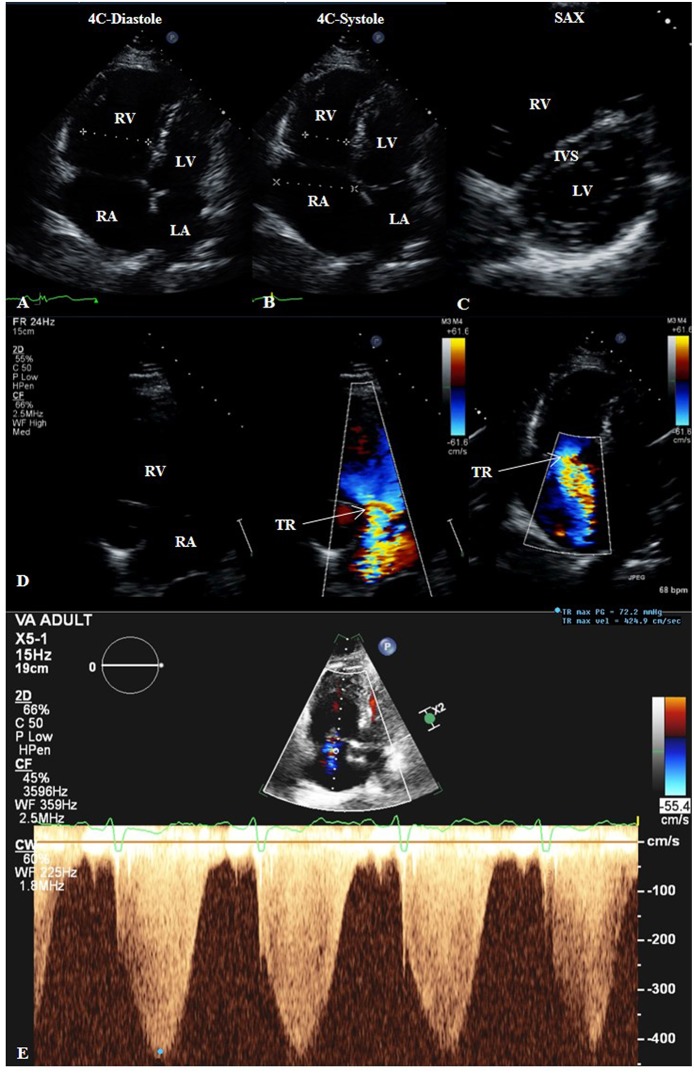 Figure 4