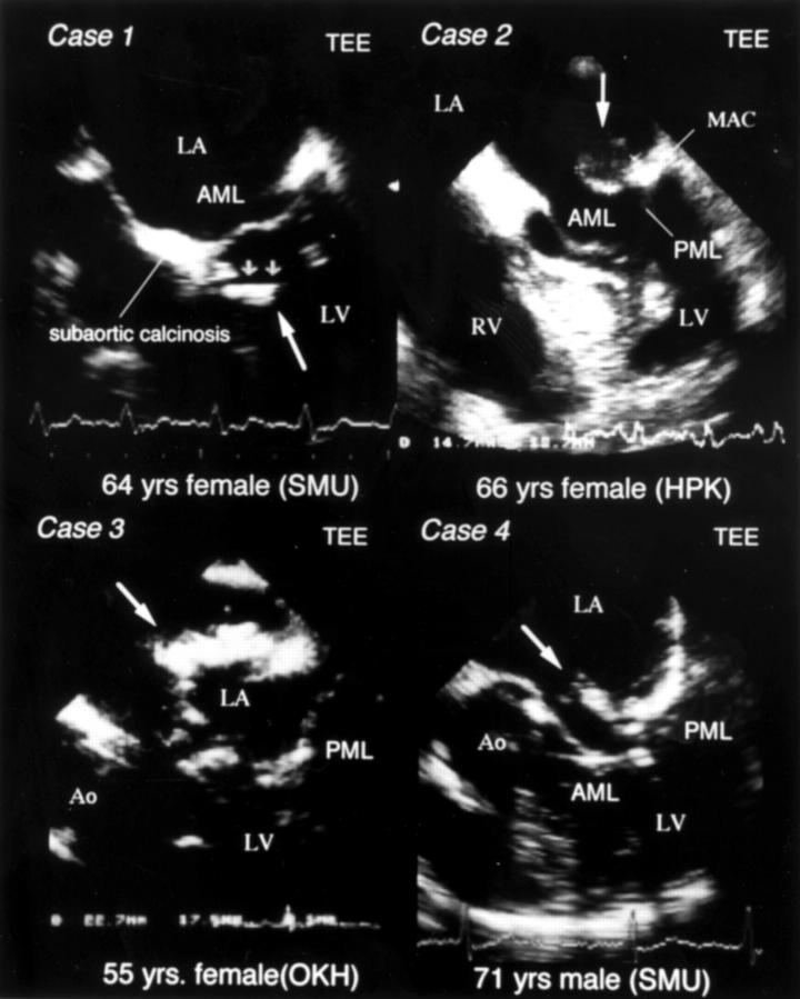 Figure 1  