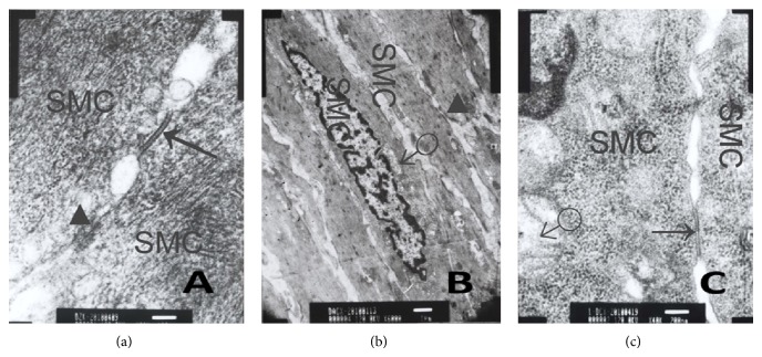 Figure 13