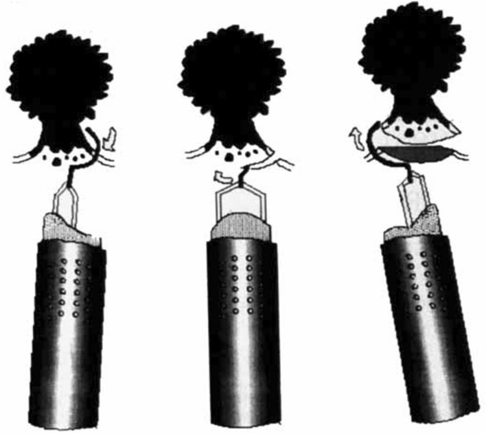 Fig. 2