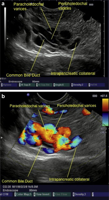 Figure 4