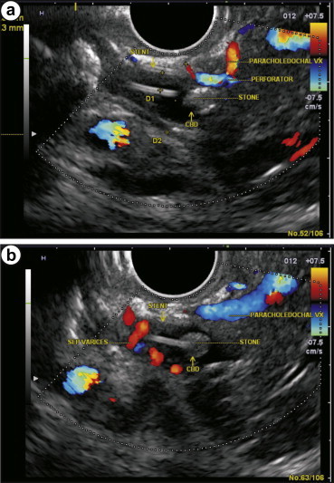 Figure 6