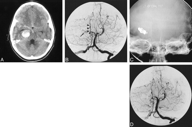 fig 2.