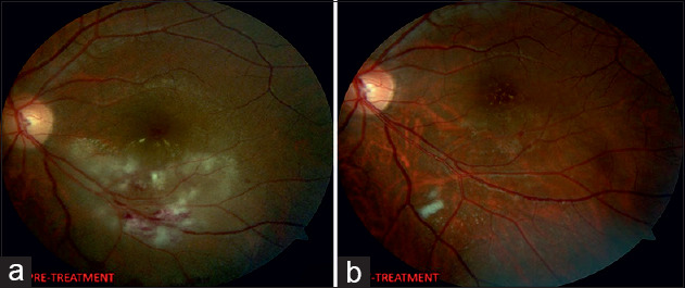 Figure 1: