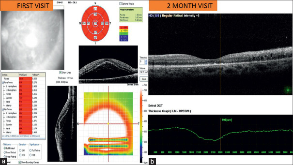 Figure 2: