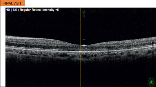 Figure 4: