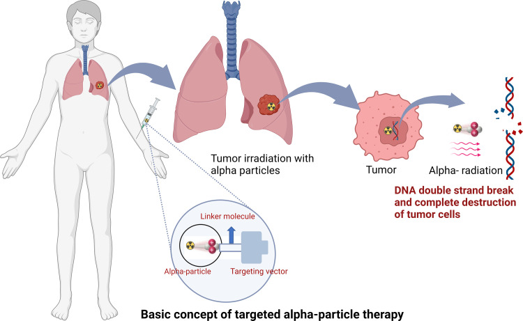 Targeted α-particle therapy schematic. The radionuclide therapy is intravenously infused and binds to the tumor through a vector linked to the radionuclide. While bound to the tumor, α-particle emission occurs, selectively delivering radiation to the tumor. α Particles are more cytotoxic than β particles because they cause irreparable double-strand DNA breaks, resulting in cell death. Created with BioRender.com.