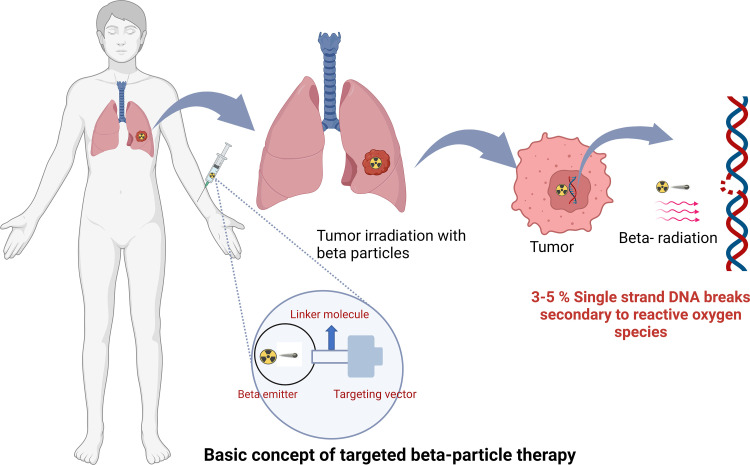 Targeted β-particle therapy schematic. While bound to the tumor, β-particle emission occurs, selectively delivering radiation to the tumor. β Particles exert therapeutic effects through reactive oxygen species, causing DNA damage via single-strand DNA breaks that may result in cell death if not repaired via DNA repair mechanisms. Created with BioRender.com.