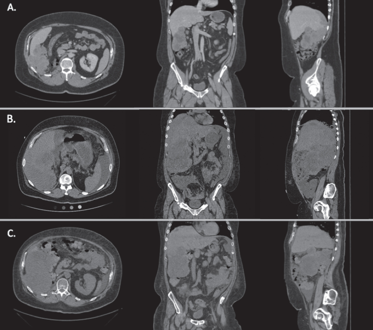 Fig.1