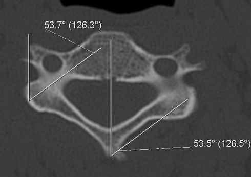 Fig. 1