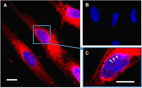 Figure 23