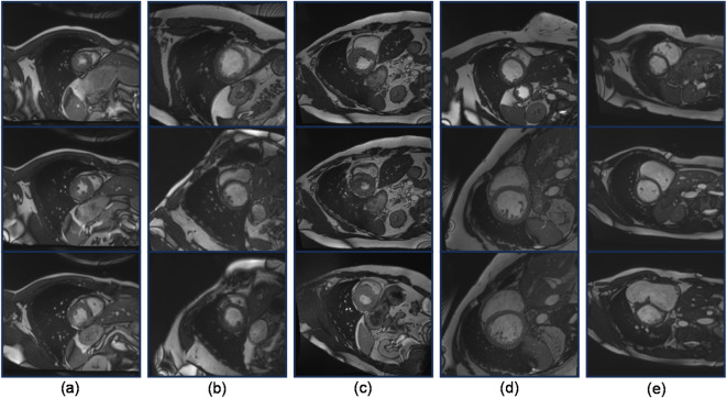 Fig. 3