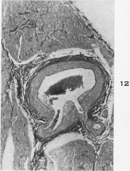 Fig. 12