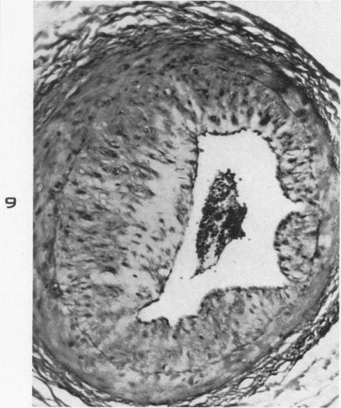 Fig. 9