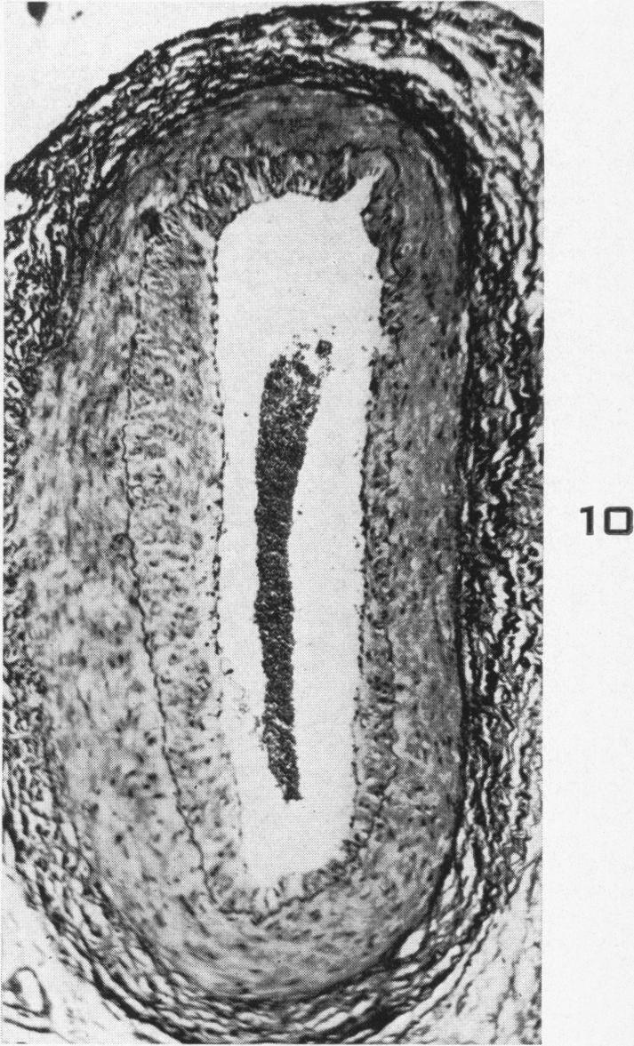 Fig. 10