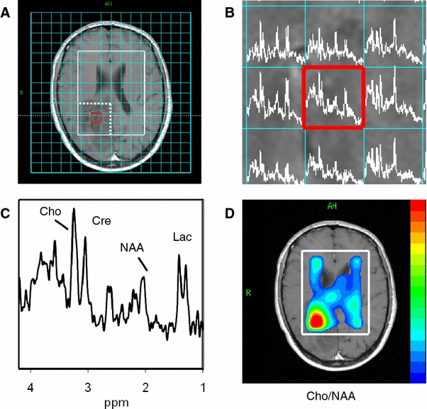 Fig. 4a–d