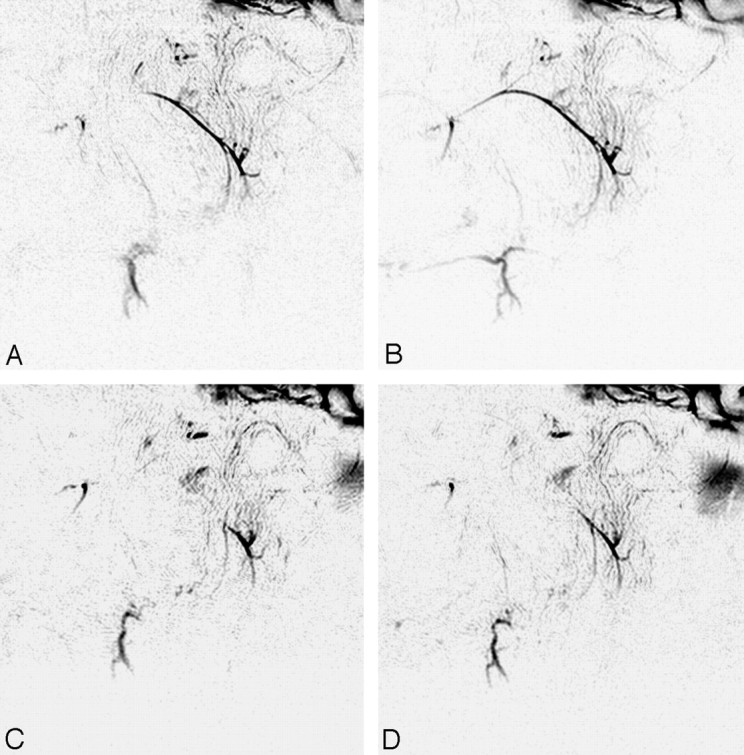 Fig 4.