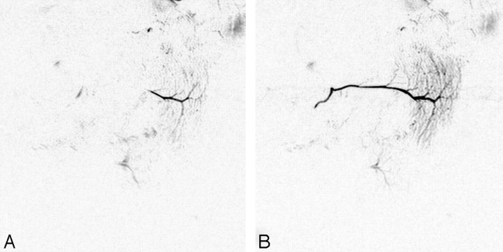 Fig 6.