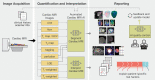 Diagram shows artificial intelligence (AI)–enabled cardiac MRI
analysis, interpretation, and reporting. In cardiac MRI, images are
collected to characterize function (ie, cine and tagging images), flow,
tissue properties and fibrosis (ie, T1 and T2 maps and T1-weighted,
T2-weighted, and extracellular volume [ECV] images), and scarring (ie, late
gadolinium enhancement [LGE] images). AI can substantially impact the
analysis workflow after imaging. The clinical reading includes
quantification (eg, function on cine images) and clinical interpretation of
individual sequences (eg, presence and location of scarring on LGE images).
AI can assist in both the analysis and interpretation of clinical readings
and can change the role of imagers to oversight.
