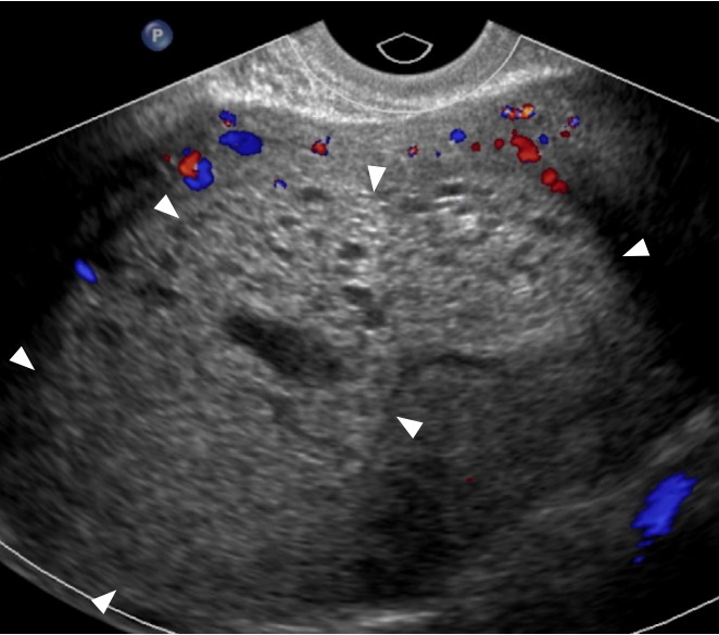 Fig. 15.