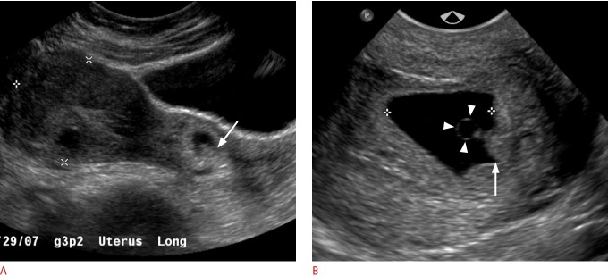 Fig. 14.