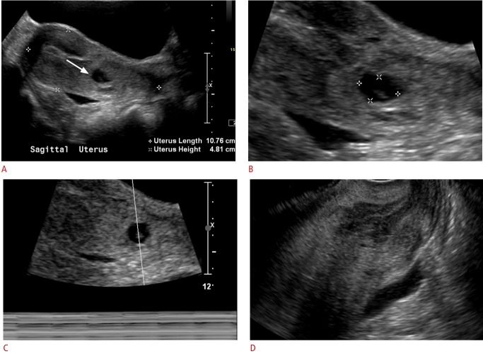 Fig. 11.