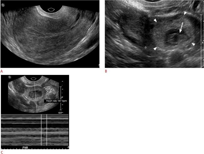 Fig. 13.